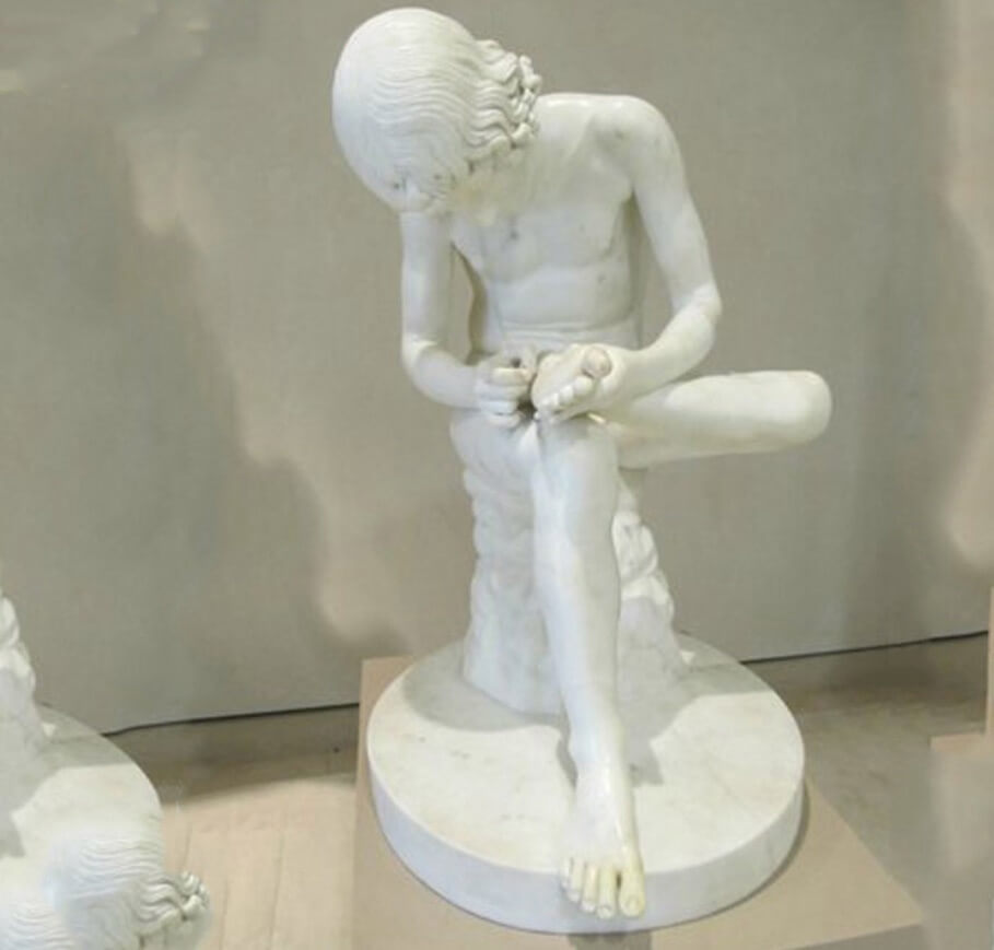 boy with a thorn in his foot statue (4)